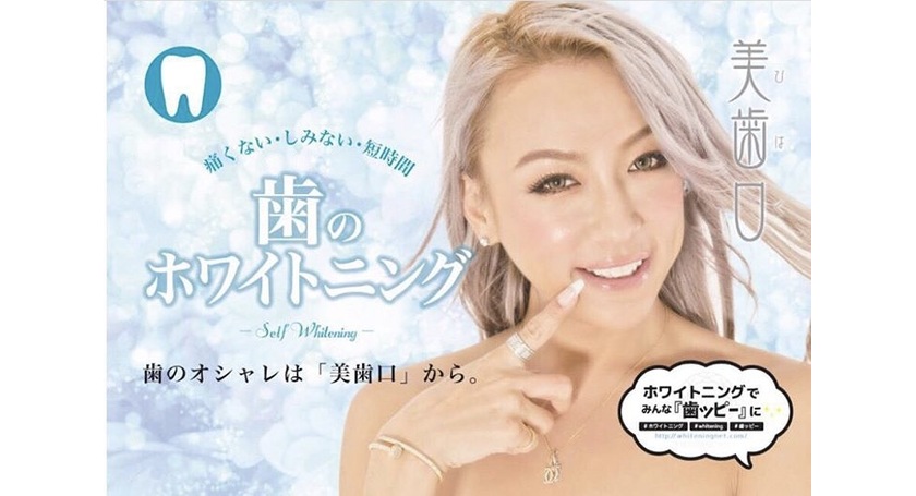セルフホワイトニング